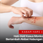 Hati-Hati Kasus Monkeypox